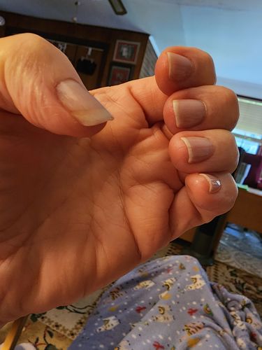 Customer photo review of Smooth Ridge Filler