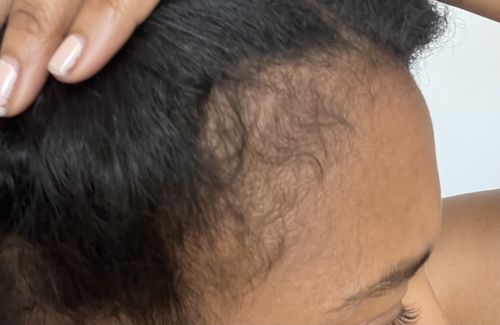 Customer photo review of Hair Growth Potion - Extra Strength
