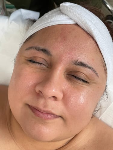 Customer photo review of Hydrating Gentle Toner