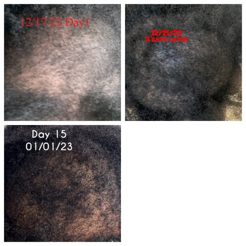 Customer photo review of Rennora Hair Growth Serum