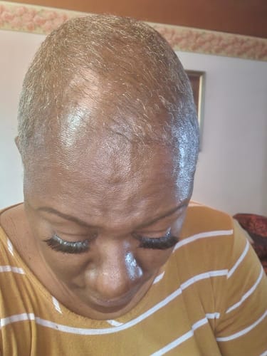 Customer photo review of Rennora Hair Growth Serum