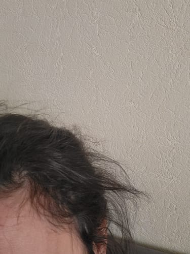Customer photo review of Good Hair Vitamines Boost - 1 mois