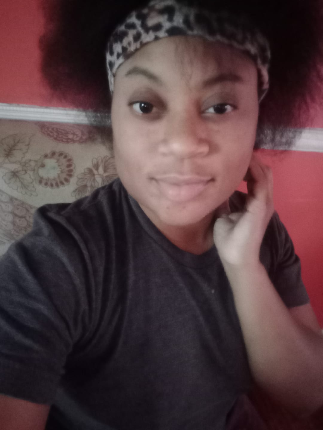 Customer photo review of Fade Cream (Fade Dark Marks)