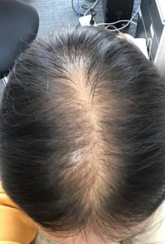 glutathione orally effective for skin whitening The Science Behind Topical Glutathione for Skin Brightening – Chicnutrix