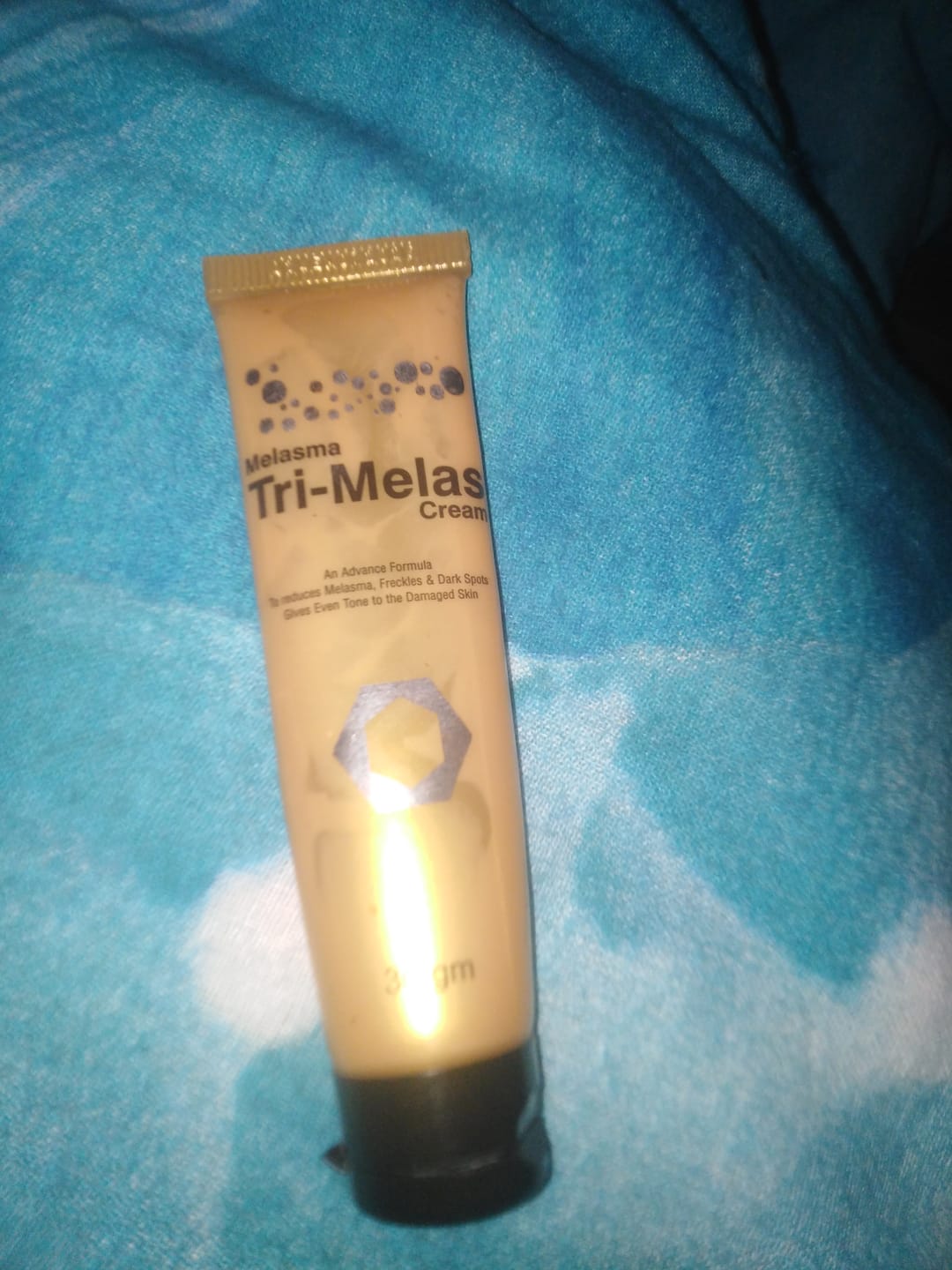 Customer photo review of SPECIAL PIGMENTATION BUNDLE (MELASMA, FRECKLES & DARK SPOTS)