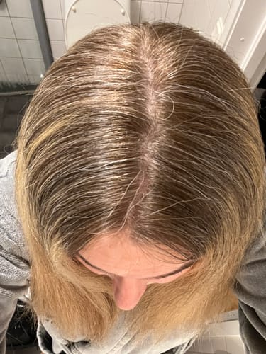 Customer photo review of Sunkissed Starter Kit