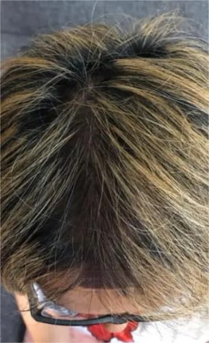 ghk cu joint pain GHK-Cu Copper Peptide Therapy for Hair & Skin in Mumbai
