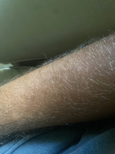 Customer photo review of Ultra Dark Drops