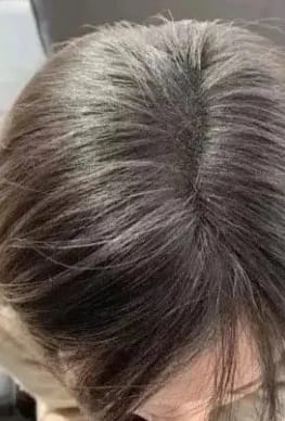Restore Max The Complete Hair Regrowth Stack Maneup Restore Max The Complete Hair Regrowth Stack Maneup