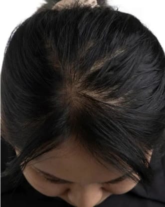 Restore Max The Complete Hair Regrowth Stack Maneup Restore Max The Complete Hair Regrowth Stack Maneup