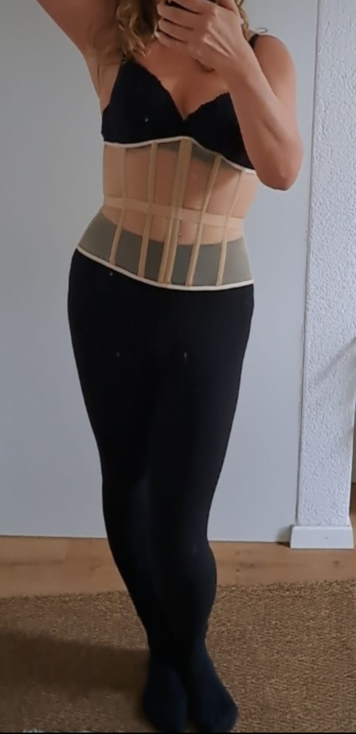 Customer photo review of Cape form