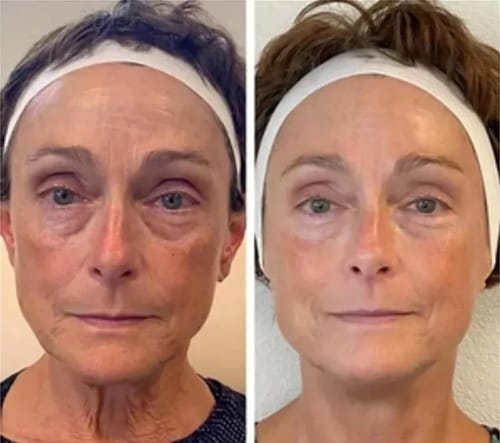 Customer photo review of Crème Anti Cernes Instantanée