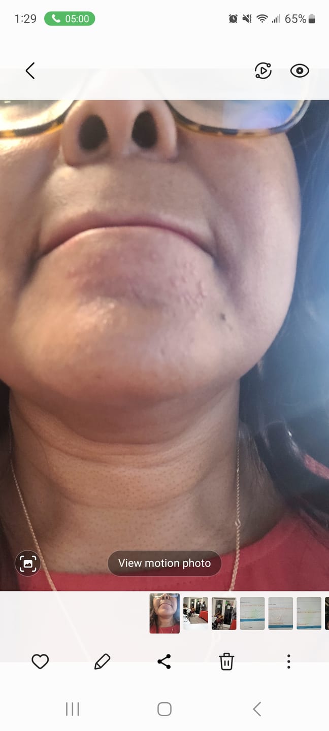 Customer photo review of Azure peptide Tansy Moisturizer