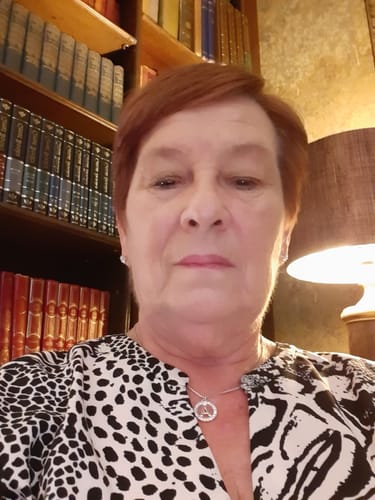 Customer photo review of Rosalique 3 in 1 Anti-Redness Miracle Formula SPF50