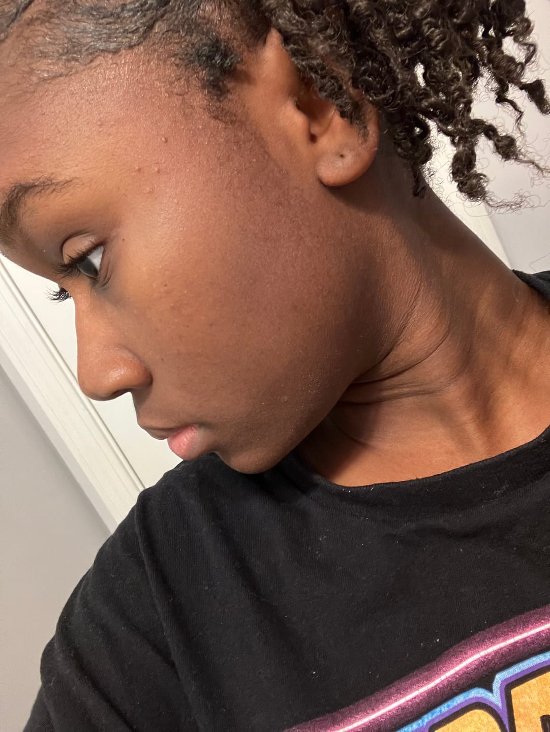 Customer photo review of Hydrating Face Moisturizer