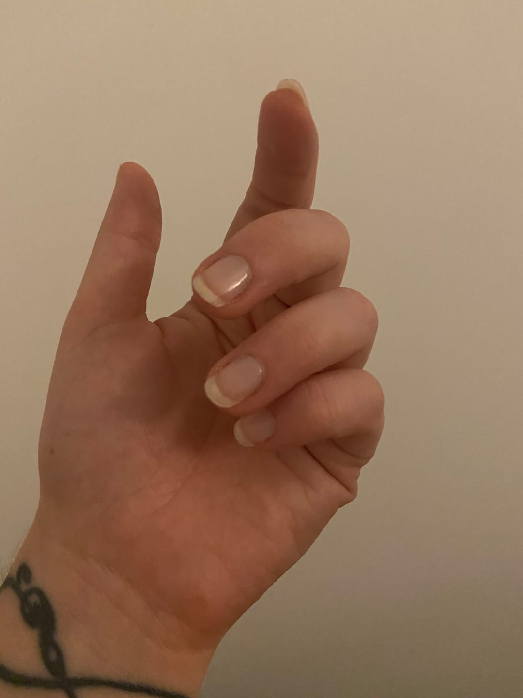 Customer photo review of Crystal Clear DIY Semicured Gel Nail Sticker Kit (STOP NAIL BITING & GROW BRITTLE NAILS)