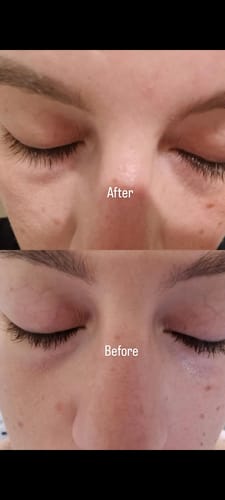 Customer photo review of LASH GROWTH SERUM