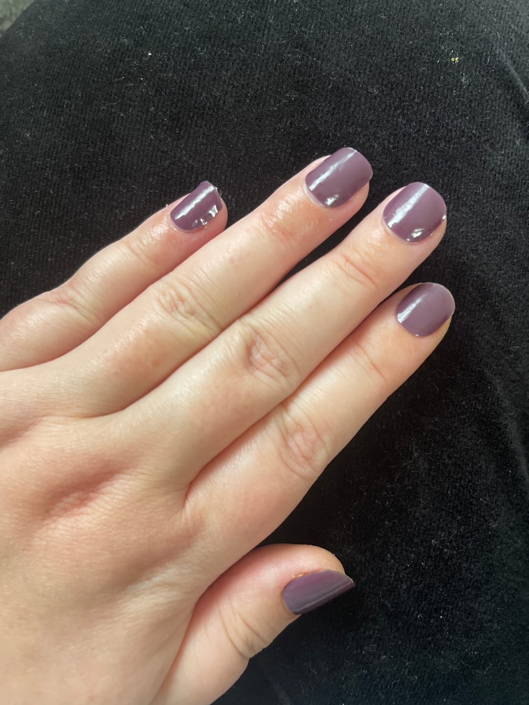 Customer photo review of Crystal Clear DIY Semicured Gel Nail Sticker Kit (STOP NAIL BITING & GROW BRITTLE NAILS)