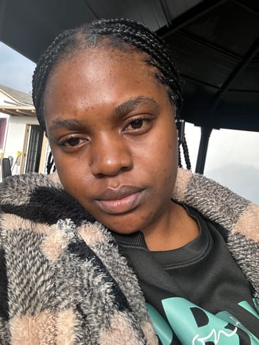 Customer photo review of Dark spot serum