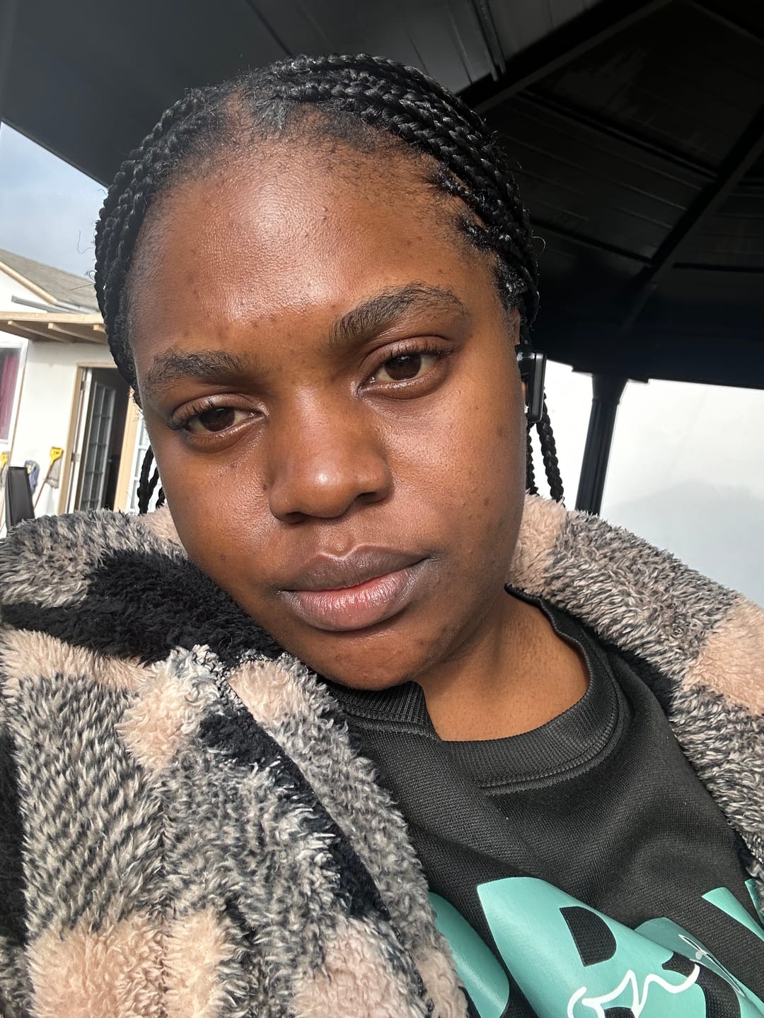 Customer photo review of Dark spot serum