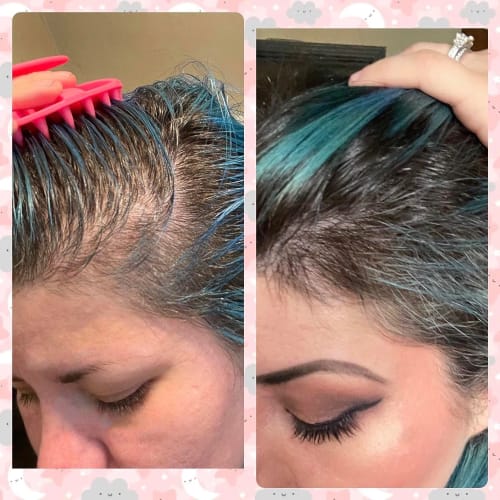 Customer photo review of Huile de romarin pour la pousse des cheveux - ECLAMA