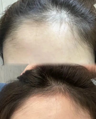 Customer photo review of Huile de romarin pour la pousse des cheveux - ECLAMA
