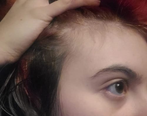 Customer photo review of Huile de romarin pour la pousse des cheveux - ECLAMA