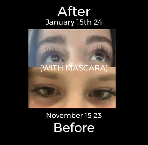 Customer photo review of LIMITED EDITION LASH BUNDLE