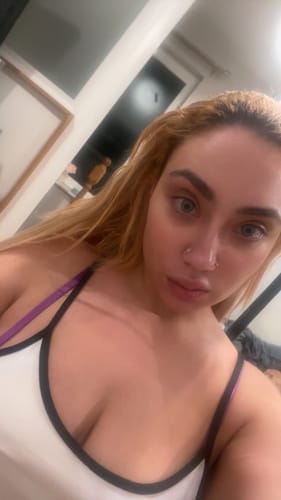 Customer photo review of BootyFix: Sculptra Butt Lift