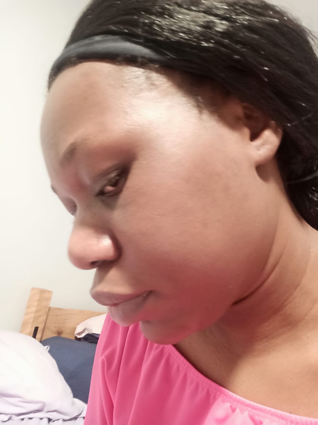 Customer photo review of Turmeric Glow wash for black spots,acne & glow