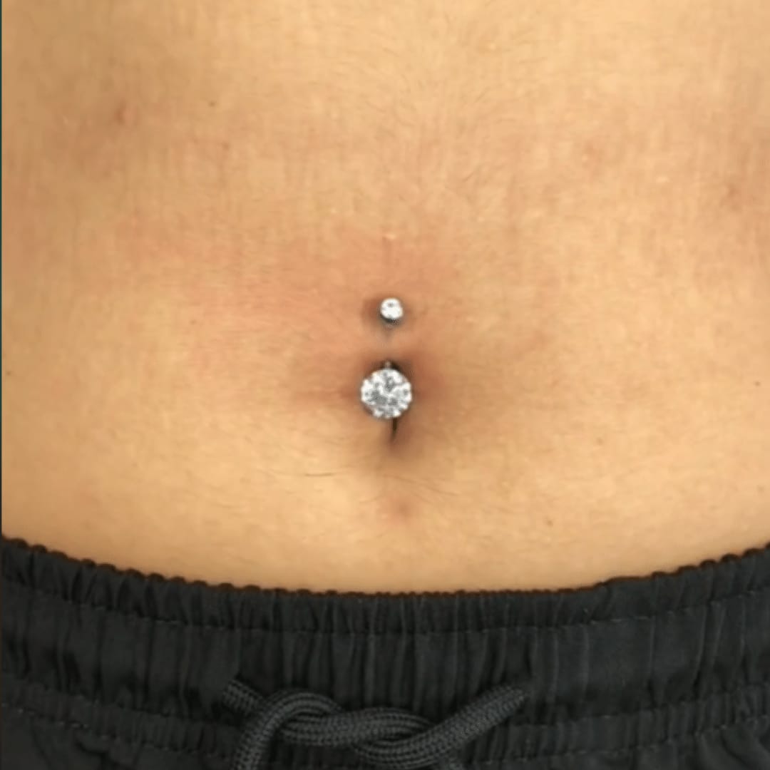 Customer photo review of Ultimate Keloid Scar Trio
