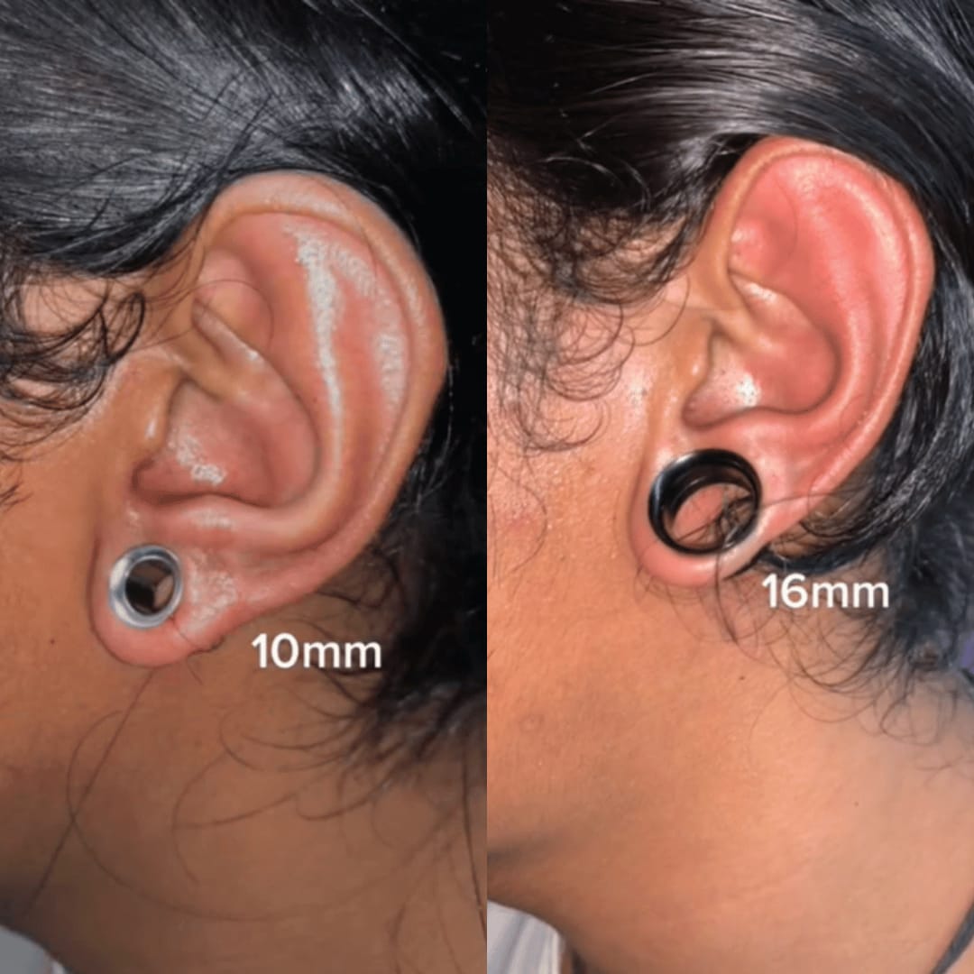 Customer photo review of Base Labs Ear-Stretch Balm
