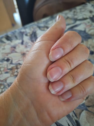 Customer photo review of Glow & Gold Collagen Starter Kit