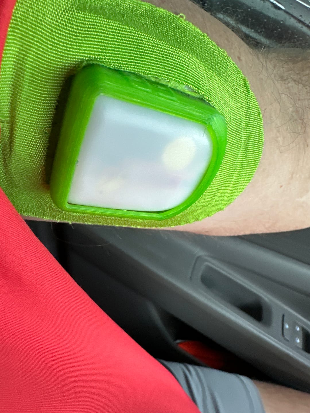 Customer photo review of Skin Grip Original - Omnipod Adhesive Patches