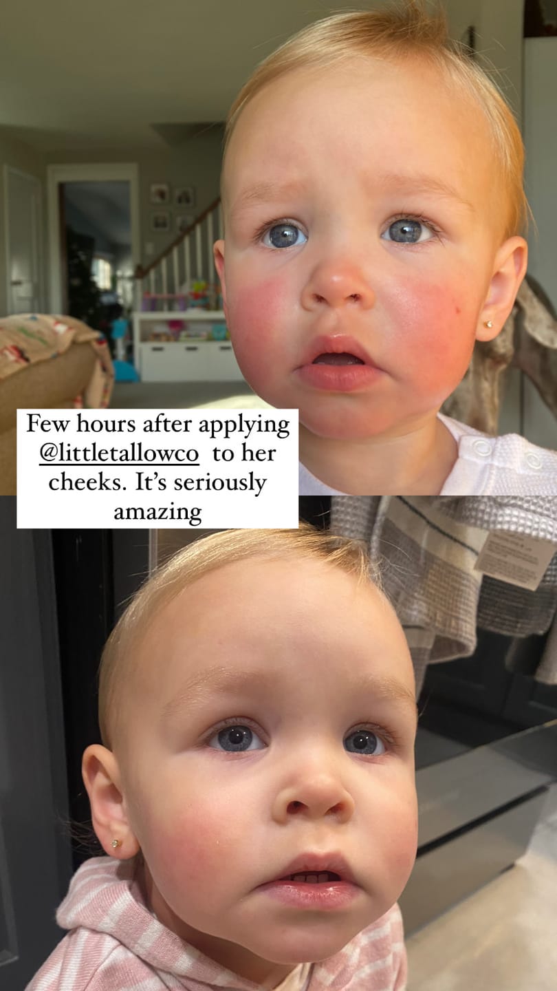Customer photo review of Everywhere Tallow Balm
