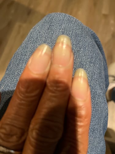 Customer photo review of Rocket Nail Fuel Nail Repair - Clear