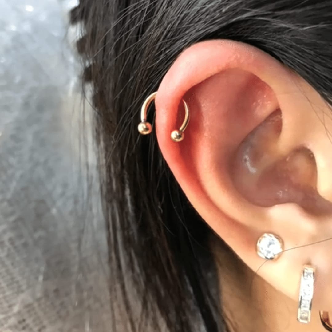 Customer photo review of Ultimate Keloid Scar Trio