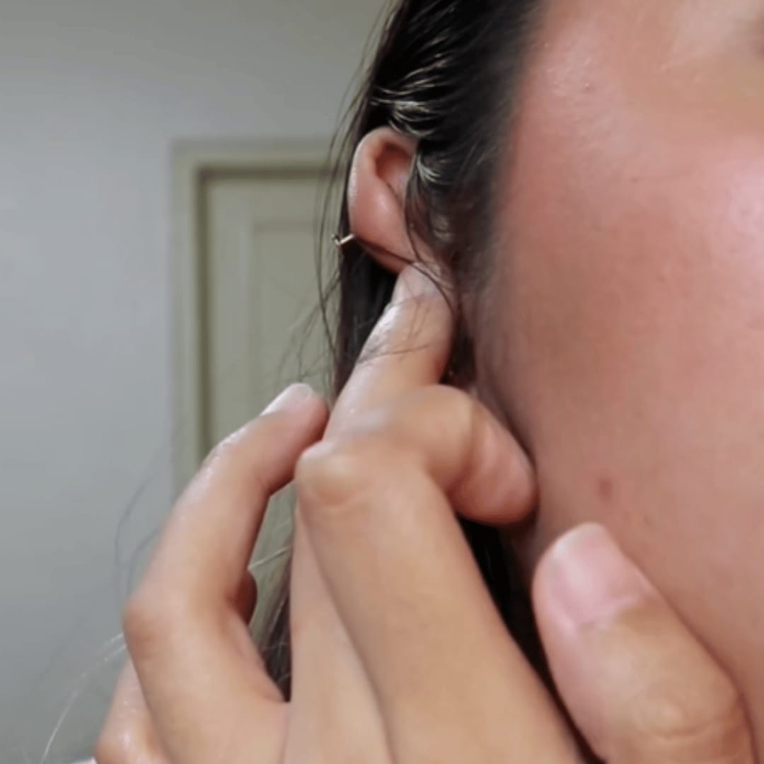 Customer photo review of Keloid Bump Shrinking Duo