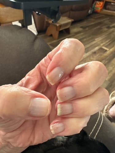 Customer photo review of Rocket Remover