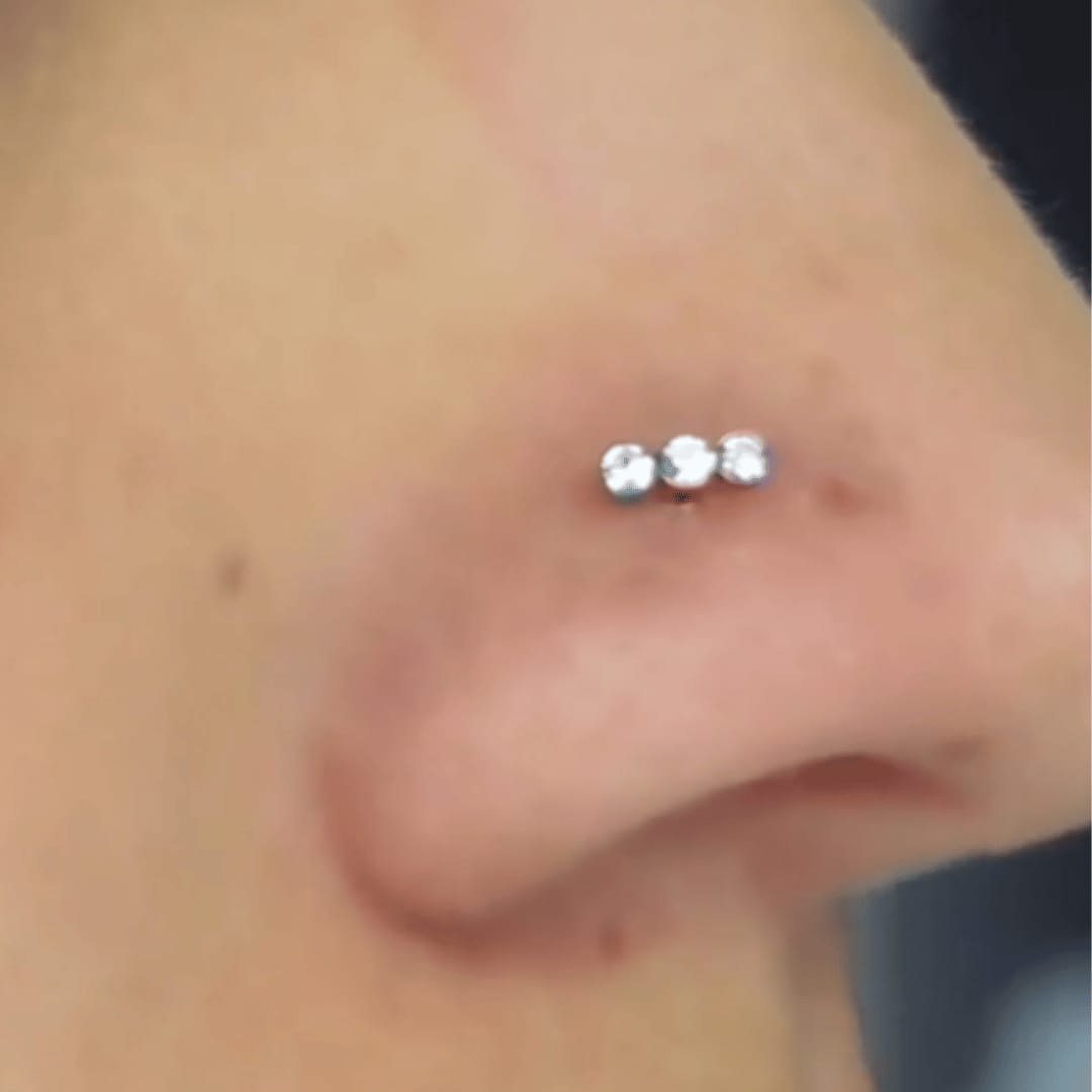 Customer photo review of Keloid Bump Shrinking Duo
