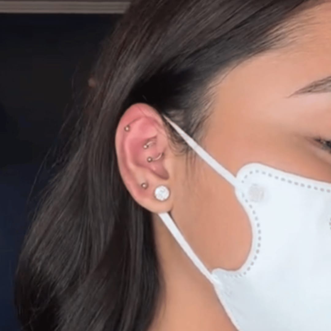 Customer photo review of Keloid Bump Shrinking Duo