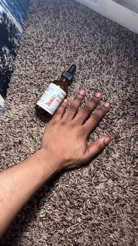 Customer photo review of Knuckle serum (removes dark knuckles)