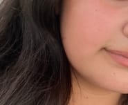 Customer photo review of Sleek Skin & Salicylic Acid