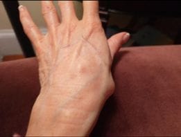 Customer photo review of 🐝 New Zealand Bee Venom Joint Bee Venom Pain and Bone Healing Cream (New Zealand Bee Extract - Specializes in Orthopedic Diseases and Arthritis Pain)