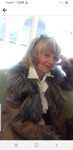 Customer photo review of Patchs Visage Anti-Rides Fontanay™ Réutilisables