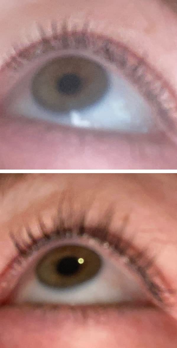 Customer photo review of LASHCOCA!NE PEPActive - Wimpernserum ohne Hormone