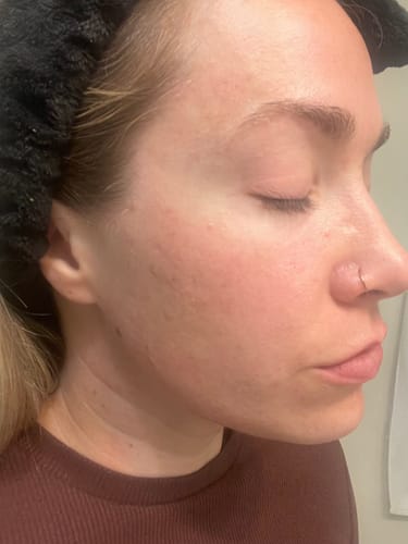 Customer photo review of Glow It All Face + Body Oil