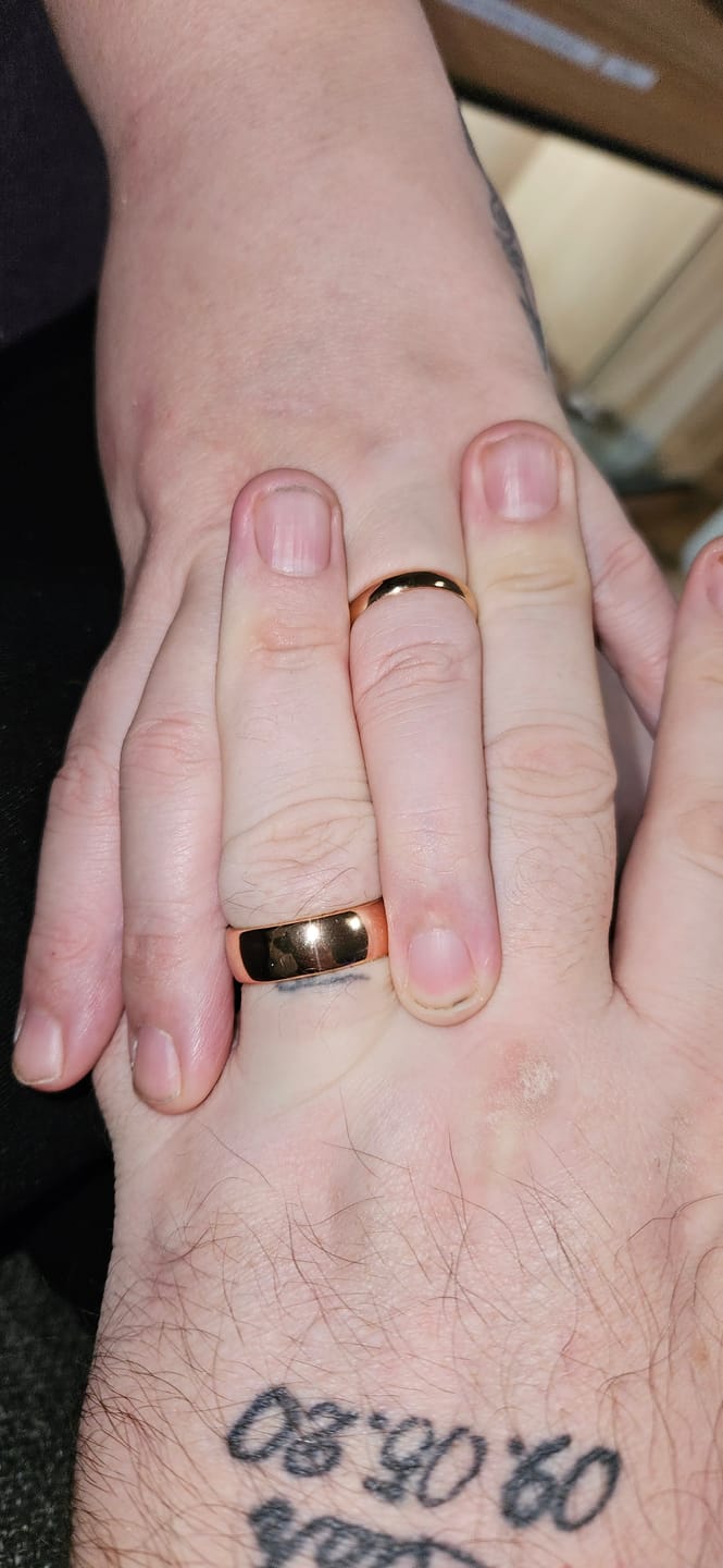 Customer photo review of Rose Gold Wonder Ring Set