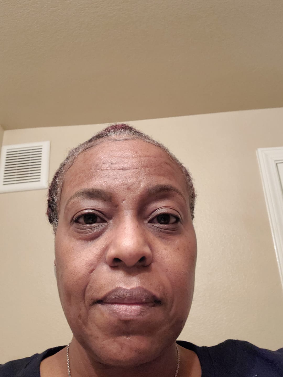 Customer photo review of Volume Eyebrow and Eyelash Serum -