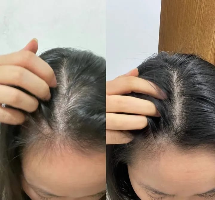 Customer photo review of Bella™ Thrive Haar Öl